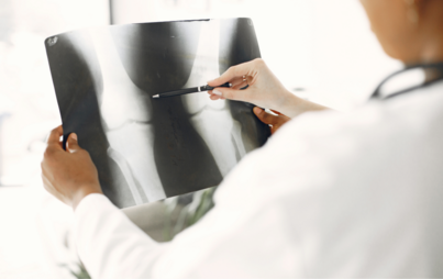 Lekarz trzymający w rękach zdjęcie rentgenowskie, wskazujący coś długopisem
